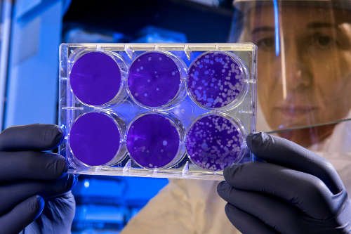 Bacterial Plates